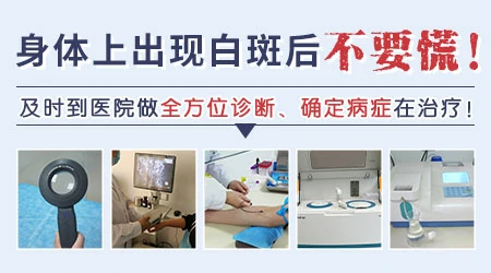 无色素痣和白癜风的图片对比