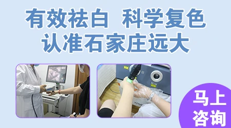 白癜风早期如何防止扩散