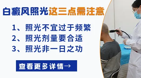 308激光治疗白癜风有没有治好的案例