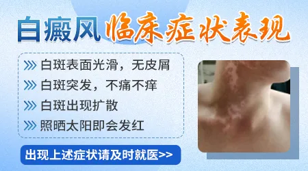 怎么分辨身上的白斑是不是白癜风