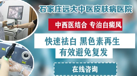 石家庄中西医结合治白癜风医院哪家好