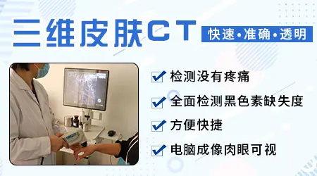 伍德灯检查能区分花斑糠疹和白癜风吗