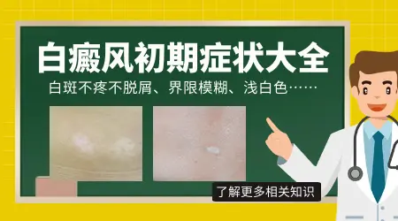 白癜风白斑初期症状图片是什么样