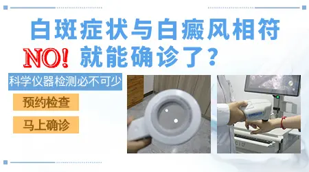 白癜风初期的白点是什么样子的图片