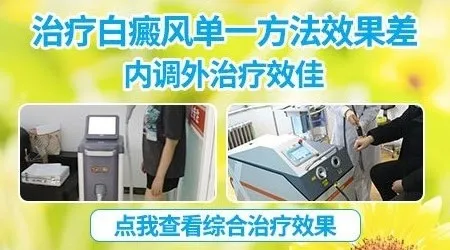 外用激素药治疗白斑有副作用吗