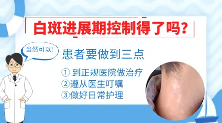 白癜风进展期怎么才能控制白斑不扩散