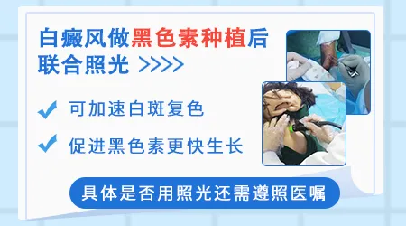 白癜风手术后多久不长黑色素岛算失败