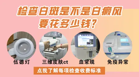 白斑检查大概需要花多少钱