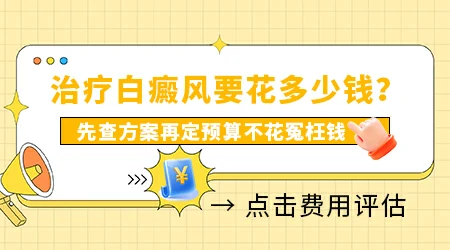 白癜风治疗的总费用大概要花多少钱