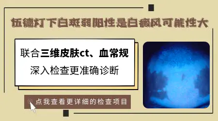 伍德灯照出来的淡白色斑是什么情况