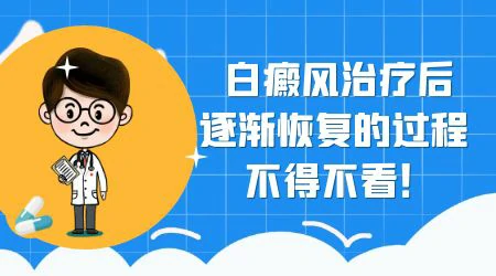 白癜风一般做几次点阵激光能治好