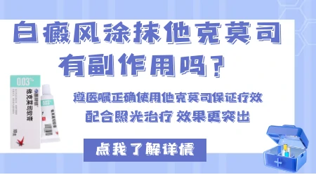 儿童白癜风能长期涂抹他克莫司软膏吗