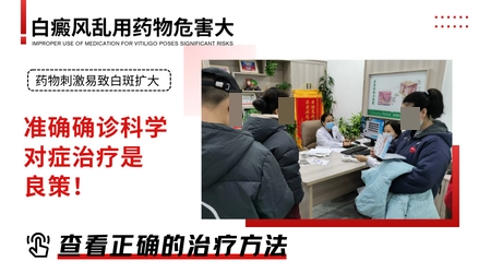吡美莫司乳膏对早期白癜风有用吗