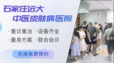 石家庄治白癜风治得好吗 哪家医院技术好