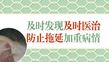 白癜风初期有什么特征图片案例