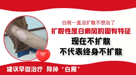 局限性不扩散的白癜风不管可以吗