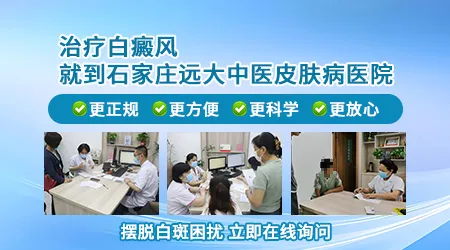 石家庄治白癜风去哪家医院比较好