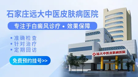 石家庄哪个医生治疗白癜风有名