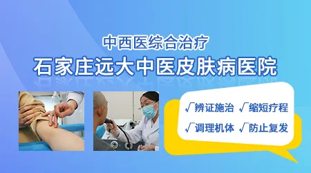 泛发性白癜风怎么治疗效果好