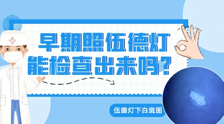 白斑刚出现颜色很淡伍德灯检查会不会误诊