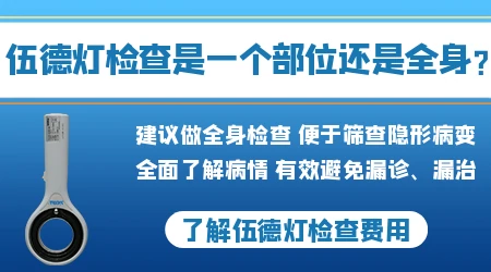 只做伍德灯检查能直接确诊白癜风吗