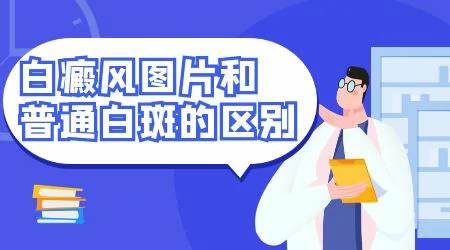 白癜风早期和普通白斑有什么区别图片