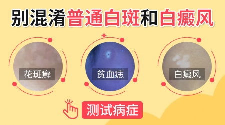小孩脸上有白斑是什么原因引起的