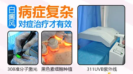 目前白癜风能不能根治
