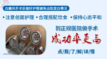 大面积白斑能不能一次手术解决 需要分几次