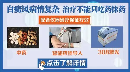 白癜风用什么药膏见效快又安全