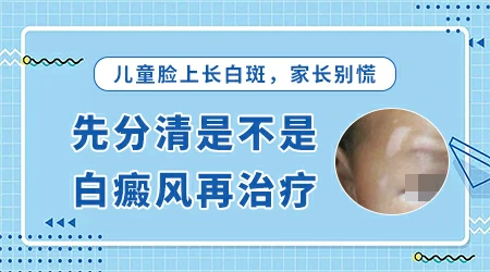 孩子脸上长白斑常见的原因有哪些