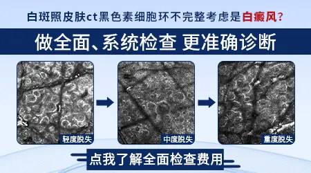 伍德灯检查的荧光颜色代表什么