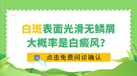 手上有白块摸着光滑就是白癜风吗