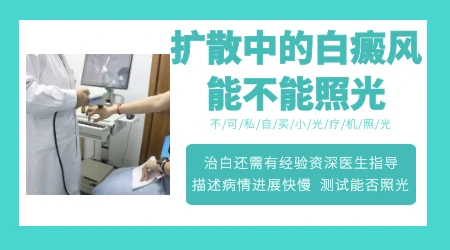 白癜风进展期做光疗会不会导致白斑扩散