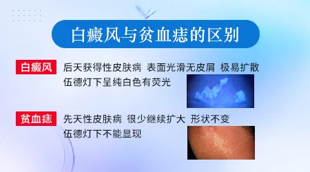 图片对比白癜风和贫血痣的区别