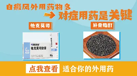 消除白斑好的药膏有哪些