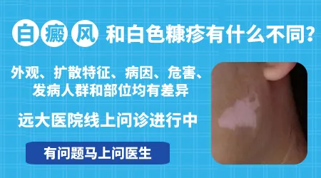 白色糠疹和白癜风有什么不一样怎么区分