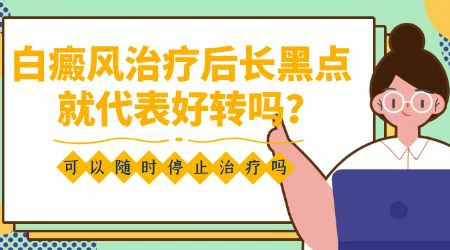 治疗白癜风有没有特效药