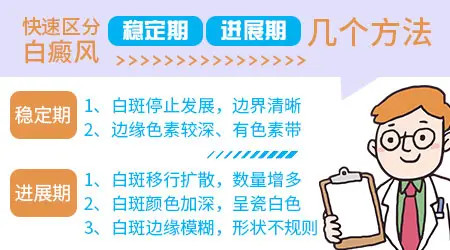 白癜风半年没扩散是不是属于稳定期