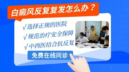 石家庄皮肤病医院哪个治白癜风好