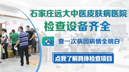 皮肤镜能区分白癜风和花斑癣吗