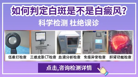 后背散发小白斑白癜风早期图片