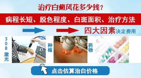 治疗白斑大概需要多少费用