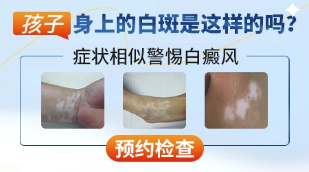 小孩屁股上白了一块是什么情况