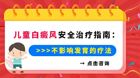 儿童白癜风怎么治疗安全效果又好