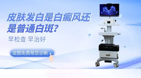 左眼尾下方皮肤发白怎么回事