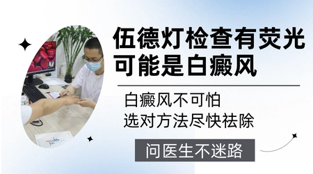 伍德灯下的白斑荧光不均匀代表什么