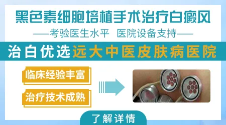 自体表皮移植治疗白癜风成功率高吗