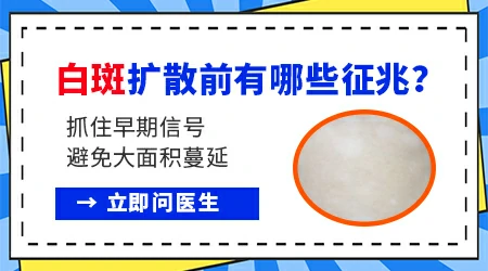 白癜风早期白斑是什么样的