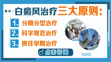 白癜风早期干预能防扩散吗